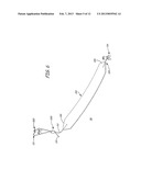 IMPLANTABLE DEVICES, TOOLS AND METHODS FOR ANATOMICAL SUPPORT diagram and image