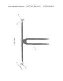 IMPLANTABLE DEVICES, TOOLS AND METHODS FOR ANATOMICAL SUPPORT diagram and image