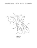 IMPLANTABLE DEVICES, TOOLS AND METHODS FOR ANATOMICAL SUPPORT diagram and image