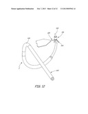 IMPLANTABLE DEVICES, TOOLS AND METHODS FOR ANATOMICAL SUPPORT diagram and image