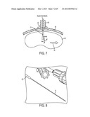 MULTI-DIRECTIONAL MICROFLUIDIC DRUG DELIVERY DEVICE diagram and image