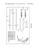 TREATMENT OF SUBCHONDRAL BONE BY BIOCHEMICAL DIAGNOSIS TO PREVENT THE     PROGRESSION OF OSTEOARTHRITIS OF THE JOINT diagram and image