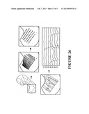 SYSTEM AND METHOD FOR MAPPING GASTRO-INTESTINAL ELECTRICAL ACTIVITY diagram and image