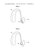 IN-EAR INFORMATION ACQUIRING APPARATUS AND FIXING MECHANISM diagram and image