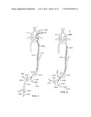 METHODS AND SYSTEMS FOR TREATMENT OF ACUTE ISCHEMIC STROKE diagram and image