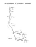 METHODS AND SYSTEMS FOR TREATMENT OF ACUTE ISCHEMIC STROKE diagram and image