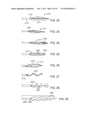 METHODS AND SYSTEMS FOR TREATMENT OF ACUTE ISCHEMIC STROKE diagram and image