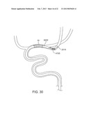 METHODS AND SYSTEMS FOR TREATMENT OF ACUTE ISCHEMIC STROKE diagram and image