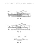 METHODS AND SYSTEMS FOR TREATMENT OF ACUTE ISCHEMIC STROKE diagram and image