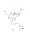 METHODS AND SYSTEMS FOR TREATMENT OF ACUTE ISCHEMIC STROKE diagram and image