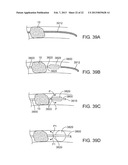 METHODS AND SYSTEMS FOR TREATMENT OF ACUTE ISCHEMIC STROKE diagram and image