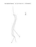 OPTICAL BANDAGE TO STERILIZE WOUNDS diagram and image