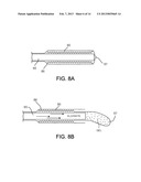 Polymer-Based Occlusion Devices, Systems and Methods diagram and image