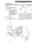 PATELLA RESECTION GUIDE WITH LOCATING FEATURES AND METHOD OF USING THE     SAME diagram and image