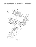 PATELLA RESECTION GUIDE WITH LOCATING FEATURES AND METHOD OF USING THE     SAME diagram and image