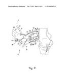 PATELLA RESECTION GUIDE WITH LOCATING FEATURES AND METHOD OF USING THE     SAME diagram and image