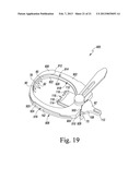 PATELLA RESECTION GUIDE WITH LOCATING FEATURES AND METHOD OF USING THE     SAME diagram and image