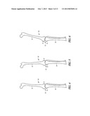 COMBINATION LIGAMENT TENSIONER AND ALIGNMENT DEVICE diagram and image