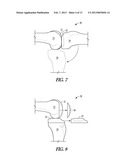 COMBINATION LIGAMENT TENSIONER AND ALIGNMENT DEVICE diagram and image