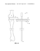 COMBINATION LIGAMENT TENSIONER AND ALIGNMENT DEVICE diagram and image