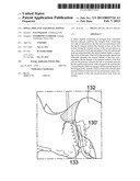 Spinal Implants and Spinal Fixings diagram and image