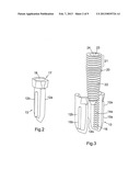 Spinal Implants and Spinal Fixings diagram and image