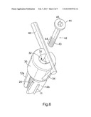 Spinal Implants and Spinal Fixings diagram and image