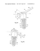 Spinal Implants and Spinal Fixings diagram and image