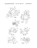 Spinal Implants and Spinal Fixings diagram and image