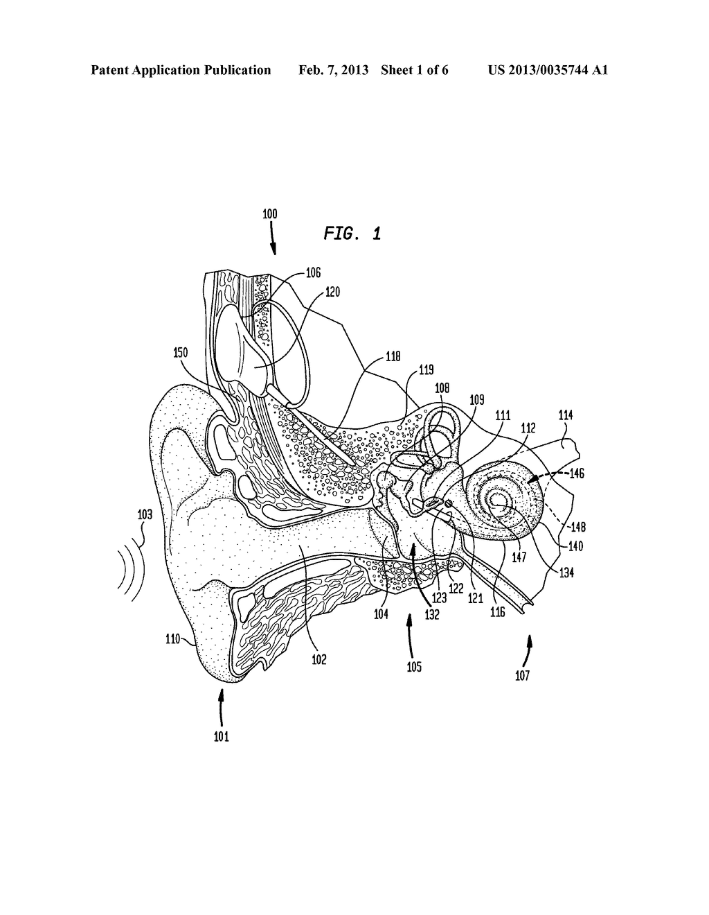 IMPLANTABLE MICROPHONE FOR AN IMPLANTABLE HEARING PROSTHESIS - diagram, schematic, and image 02