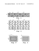 DRUG-DELIVERY ENDOVASCULAR STENT AND METHOD OF FORMING THE SAME diagram and image