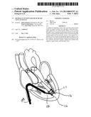 MINIMALLY INVASIVE REPAIR OF HEART VALVE LEAFLETS diagram and image