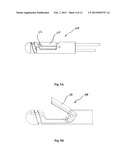 MINIMALLY INVASIVE REPAIR OF HEART VALVE LEAFLETS diagram and image