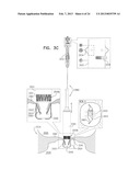 TECHNIQUES FOR PERCUTANEOUS MITRAL VALVE REPLACEMENT AND SEALING diagram and image