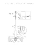 TECHNIQUES FOR PERCUTANEOUS MITRAL VALVE REPLACEMENT AND SEALING diagram and image