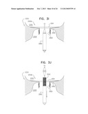 TECHNIQUES FOR PERCUTANEOUS MITRAL VALVE REPLACEMENT AND SEALING diagram and image