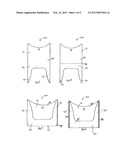 TRACHEOTOMY SHIELD diagram and image