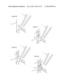 MEANS FOR IMPROVED LIQUID HANDLING IN A MICROPLATE diagram and image