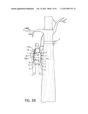 Controlled Descent System with an Increased Recovery Range diagram and image