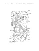 Controlled Descent System with an Increased Recovery Range diagram and image