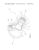 Overmolding Ball Valve diagram and image