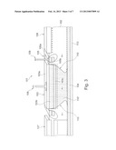 SEMICONDUCTOR STRUCTURE FOR PHOTON DETECTION diagram and image