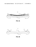 ICE HOCKEY RUNNER-BLADE ASSEMBLY diagram and image