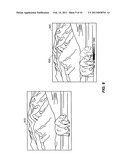 SYSTEMS AND METHODS TO CAPTURE A STEREOSCOPIC IMAGE PAIR diagram and image