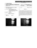 IDENTIFICATION OF DENTAL CARIES IN LIVE VIDEO IMAGES diagram and image
