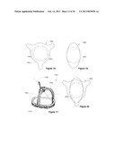 SYSTEM AND METHOD FOR WEIGHTED ATLAS GENERATION diagram and image