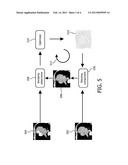 IMAGE DATA REGISTRATION FOR DYNAMIC PERFUSION CT diagram and image