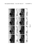 METHOD FOR IMPROVING IMAGE QUALITY diagram and image