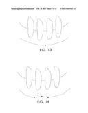 METHODS FOR THE COMPENSATION OF IMAGING TECHNIQUE IN THE PROCESSING OF     RADIOGRAPHIC IMAGES diagram and image