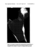 METHODS FOR THE COMPENSATION OF IMAGING TECHNIQUE IN THE PROCESSING OF     RADIOGRAPHIC IMAGES diagram and image